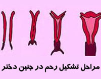 برخی زنان دو رحم دارند